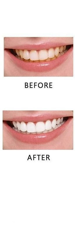 Snowbeam teeth whitening powder